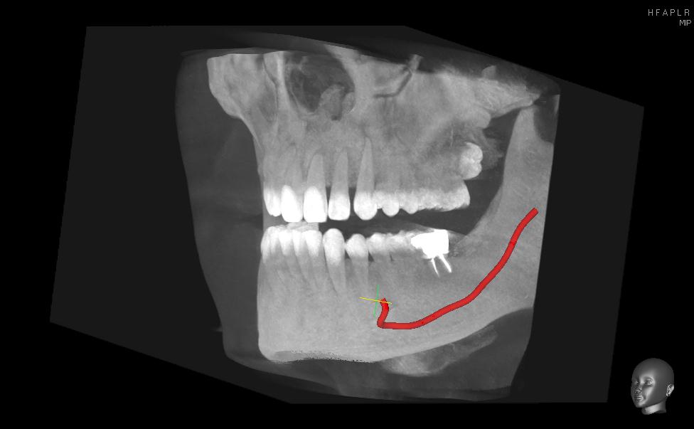 Cone-Beam-radiologia-odontoiatrica-digitale