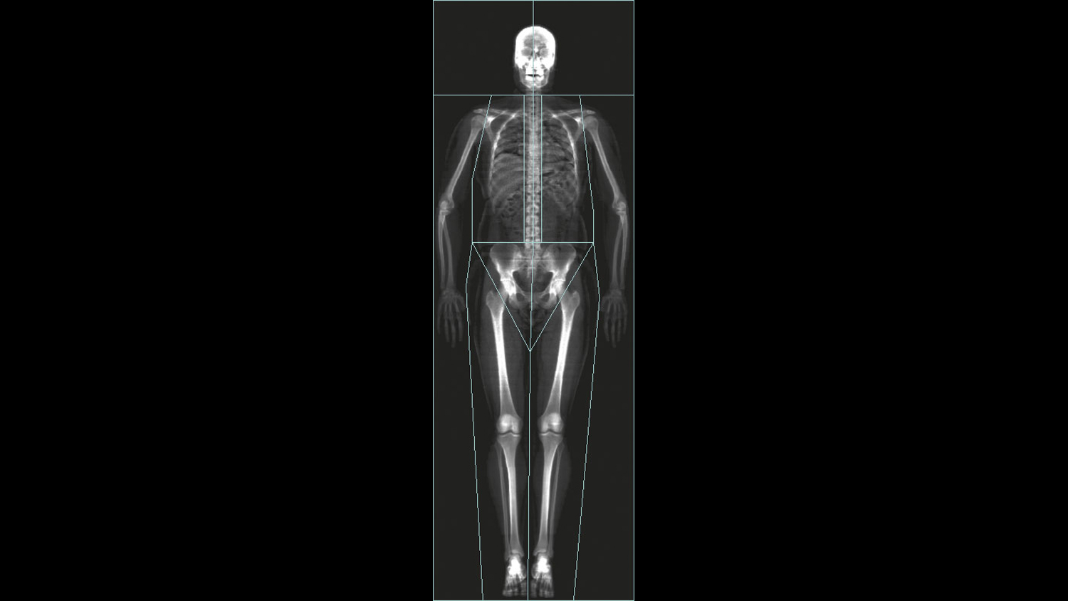 moc-radiografia